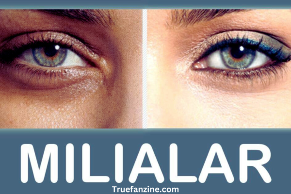 milialar